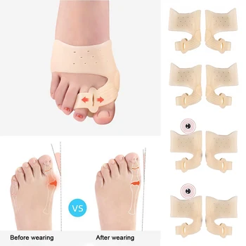Terapia De Silicon De La Picioare Separator De Inflamație La Picior Os Ectropion De Reglare De La Picioare Îngrijire Picior Îndreptat Corector Unisex